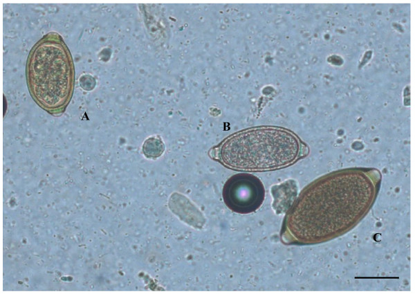 Eggs-ofCapillaria-boehmiA-Capillaria-aerophilaB-andTrichuris-vulpisC-detected-by