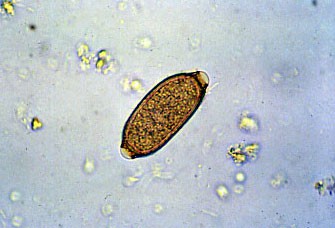 capillaria-egg