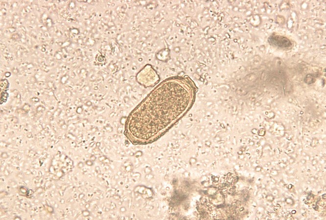 capillaria-eggs