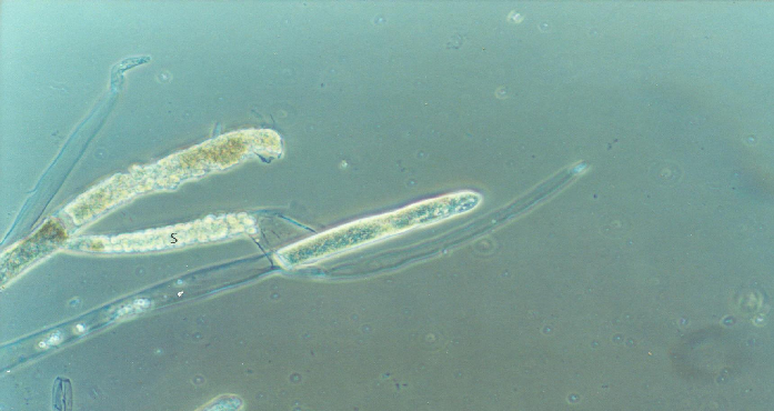 Saprolegniasis-in-C-idella