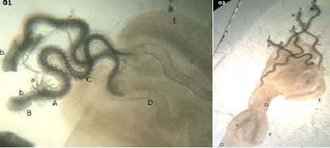 Trypanorhyncha-genus-Molicola-larval-stage