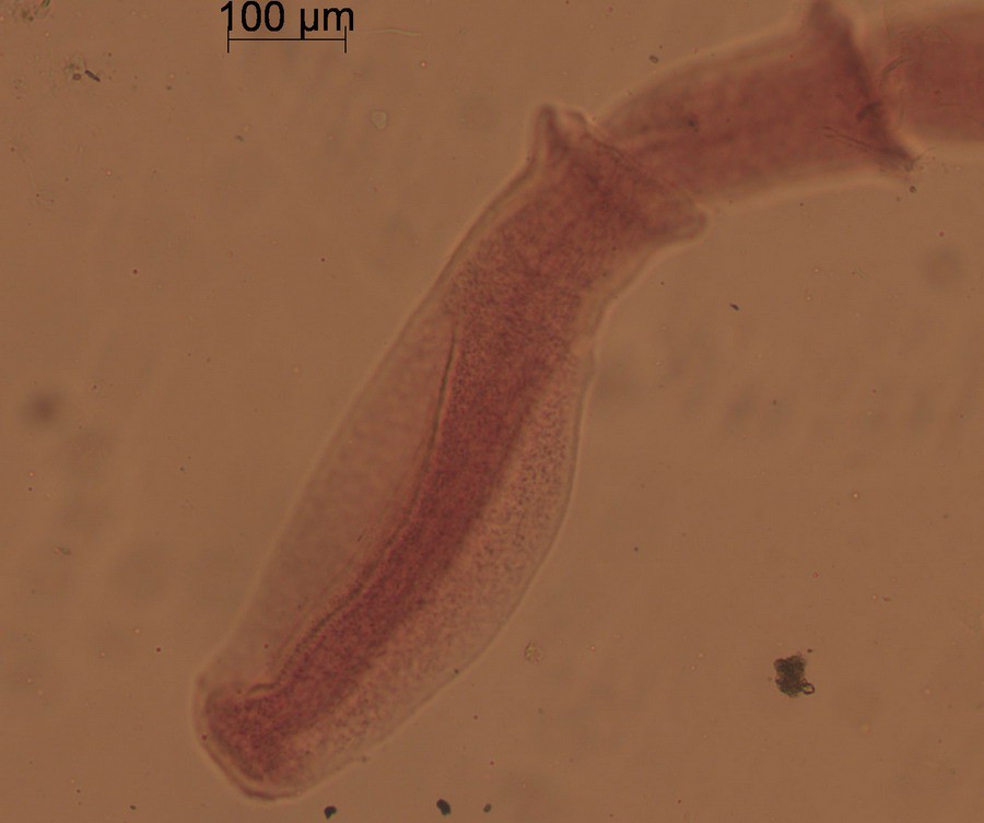 bothriocephalus_scorpii