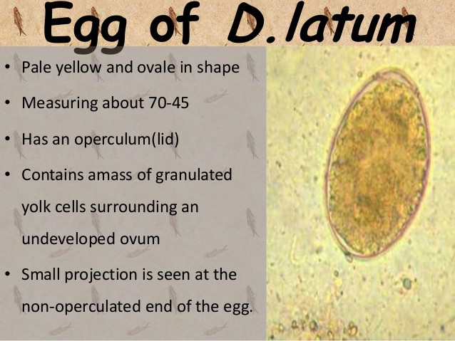 diphyllobothrium-latum