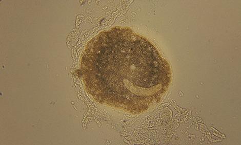 ichthyophthirius-multifiliis