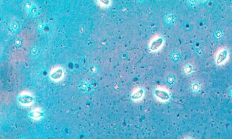 l-hole-in-head-disease-spironucleus-hexamita-flagellates-protoopalina
