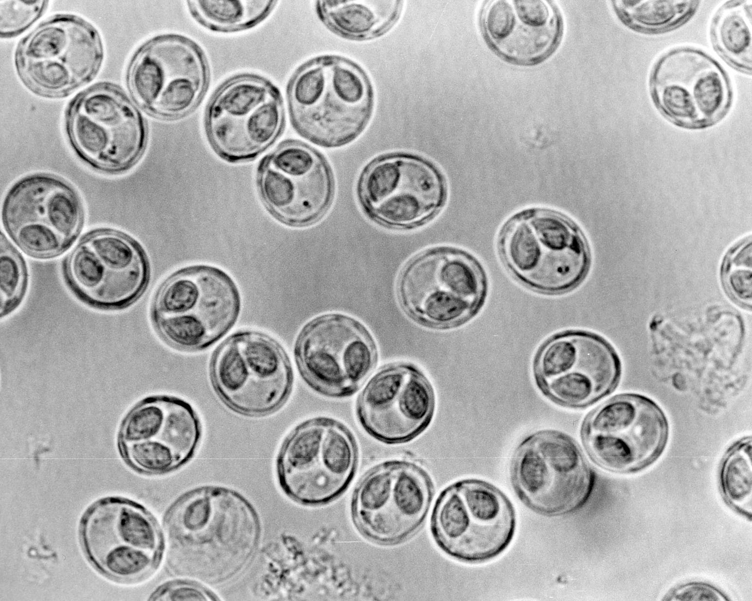 Myxobolus portucalensis Sporen (c) Klaus Knopf